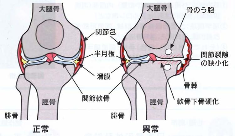 原因・病態